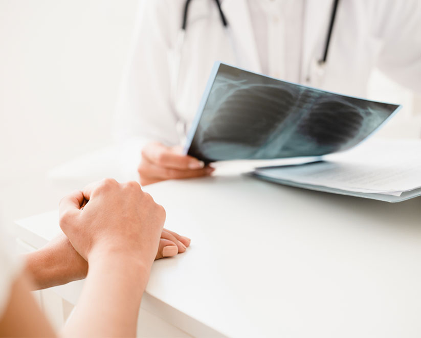A doctor holding a chest xray
